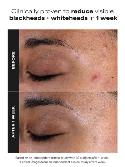 2% BHA Exfoliating Toner Pads