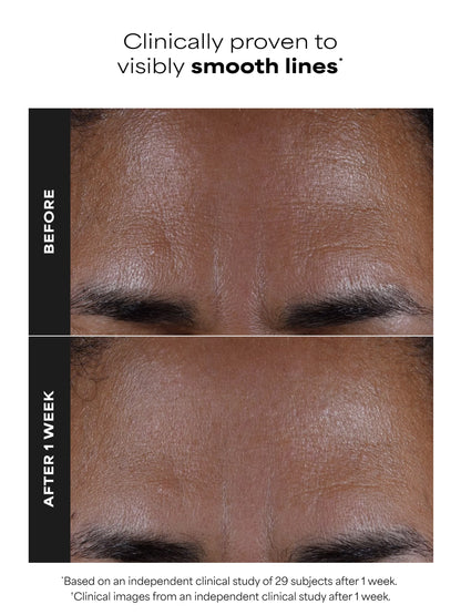 2% BHA Liquid Exfoliant