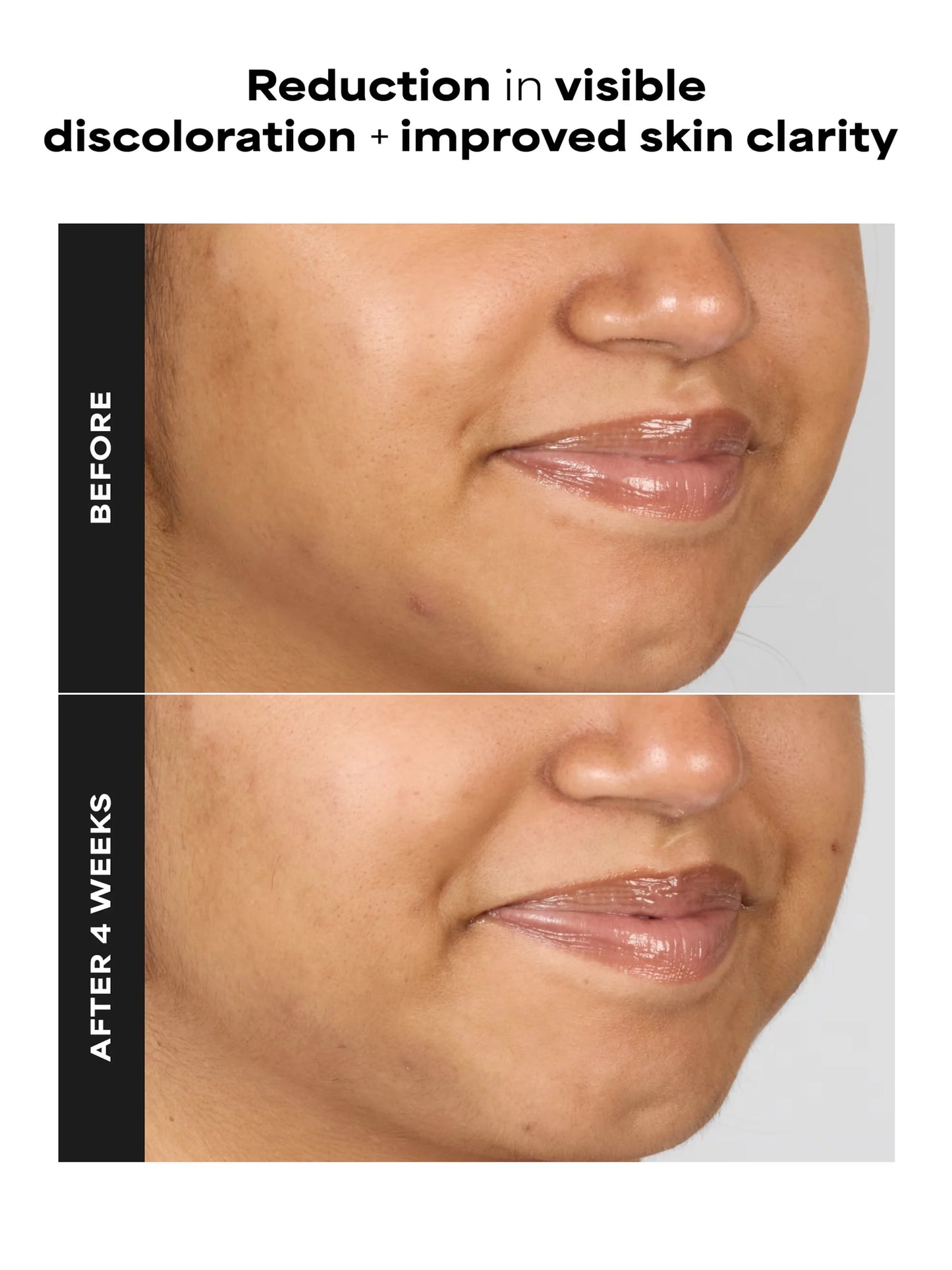 1% BHA Gentle Exfoliating Gel Toner