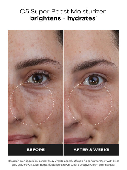 C5 Super Boost Moisturizer