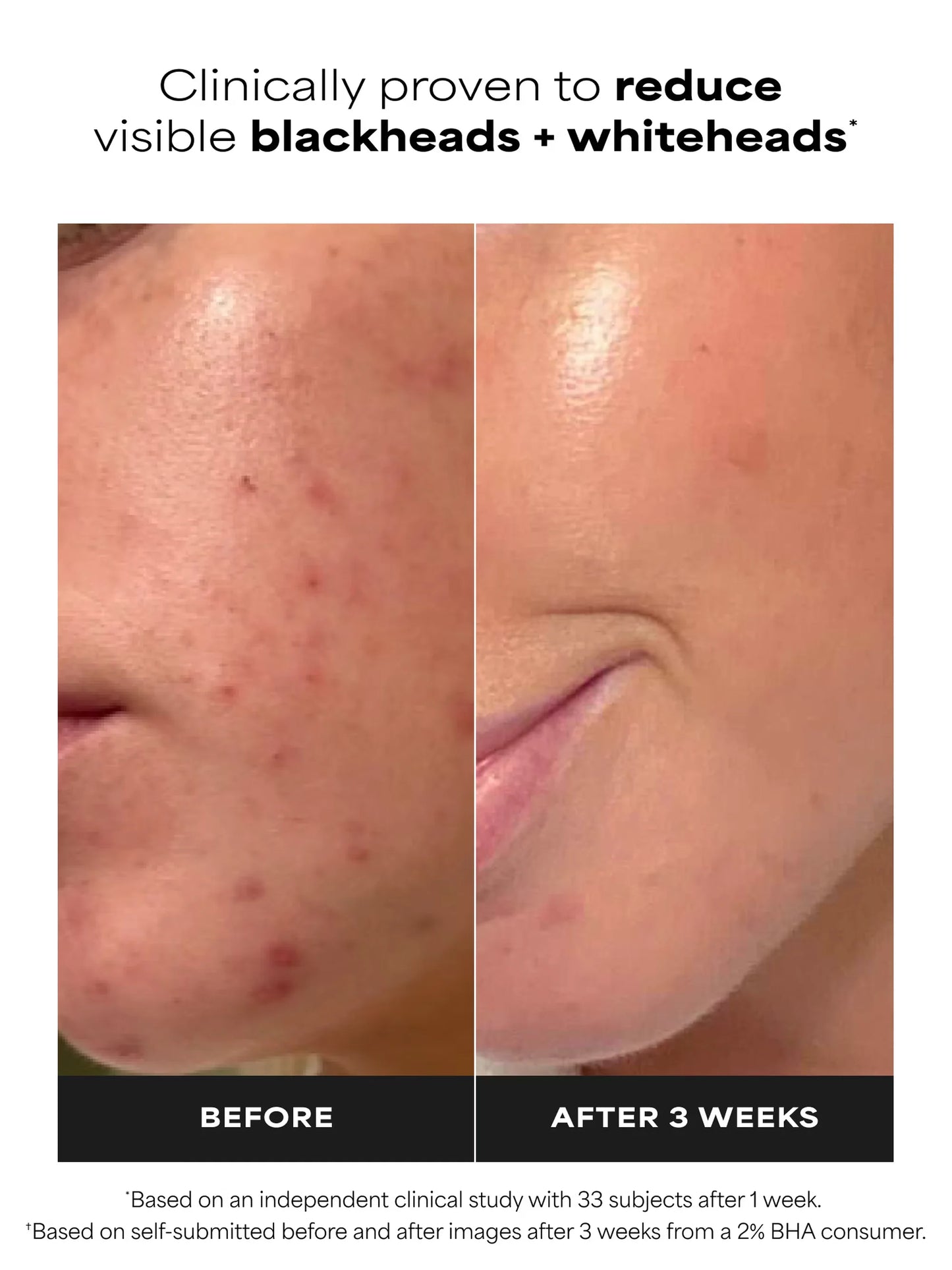 2% BHA Liquid Exfoliant