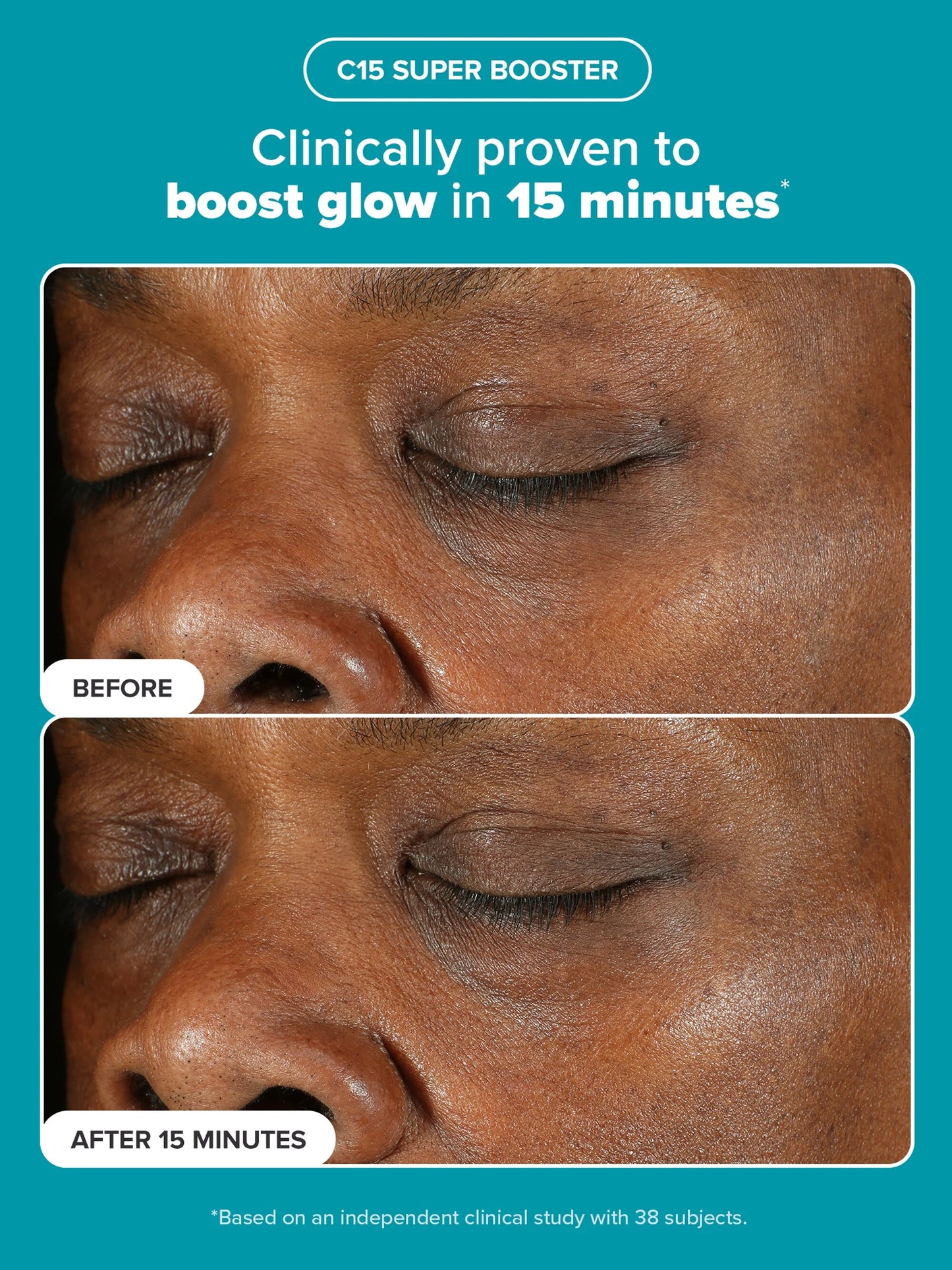 Clarify, Even & Brighten Kit