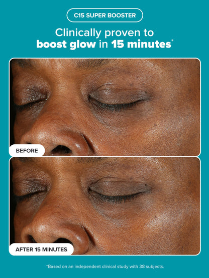 Clarify, Even & Brighten Kit