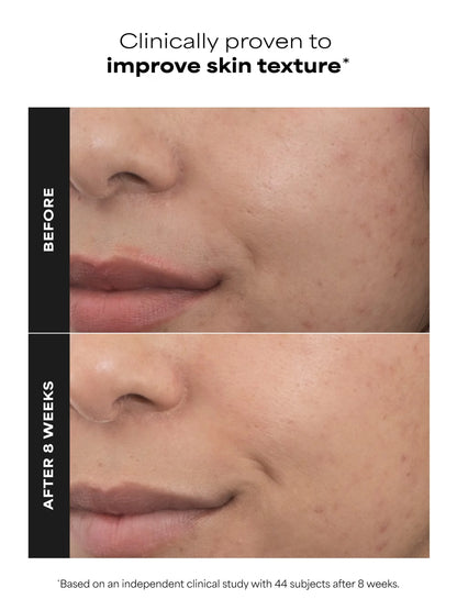 PRO Retinaldehyde Dual-Retinoid Treatment