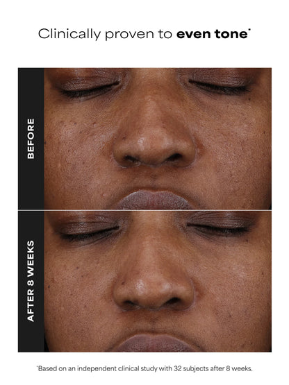 25% Vitamin C + Glutathione Clinical Serum