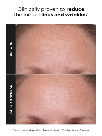 1% Retinol Treatment